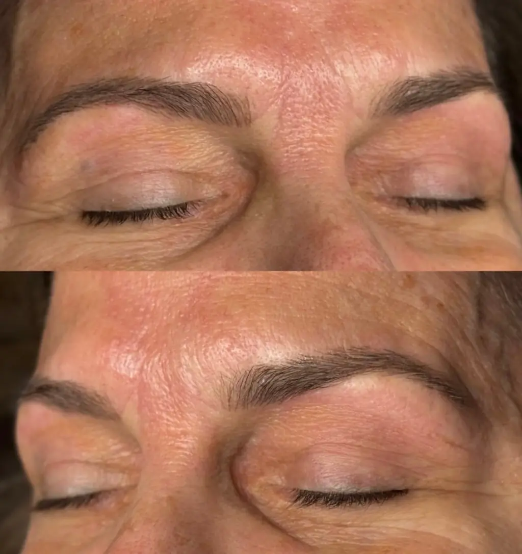 A client's brows before (top) and after (bottom) a brow service with Katie